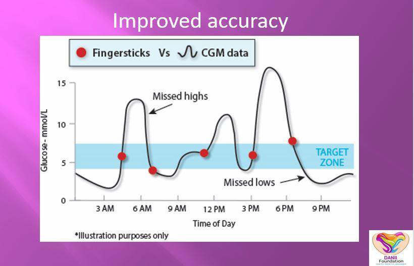 CGMHowdoIgetcontinuousglucosemonitoring Diabetes Innovation Management