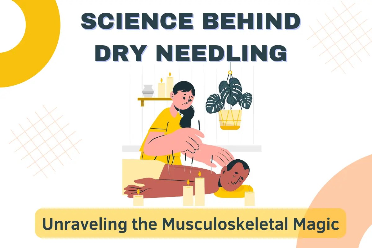 Science Behind Dry Needling Discover the Musculoskeletal Magic