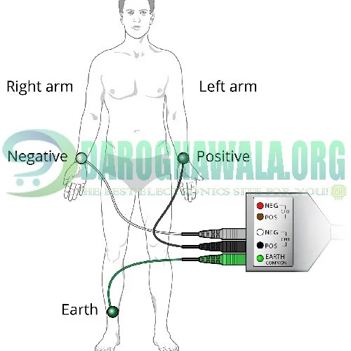 ECG Electrodes with Metal Snap and Low Impedance Solid Medical