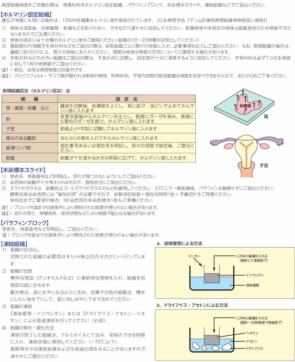 胃癌HER2/neu 《IHC法》｜病理組織検査｜病理学検査｜検査項目解説｜臨床検査｜LSIメディエンス