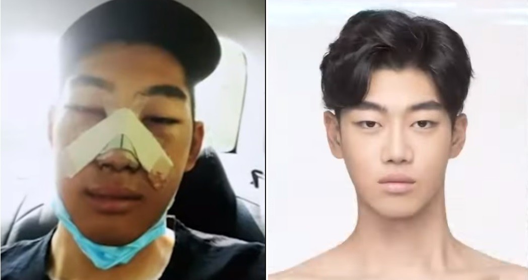 More South Korean Men Are Having Plastic Surgery to Look 'Pretty' Like
