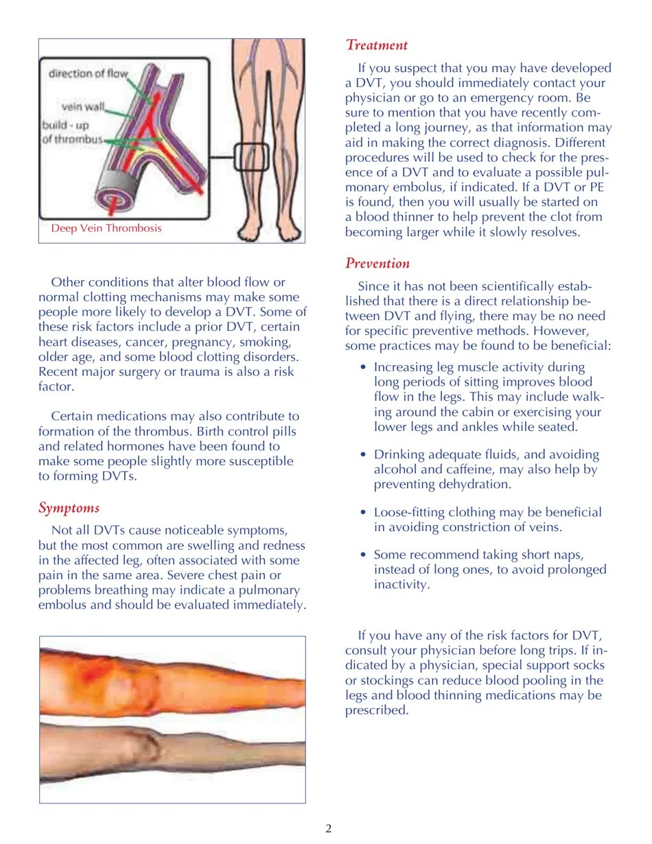 Deep Vein Thrombosis and Travel Fill Out, Sign Online and Download