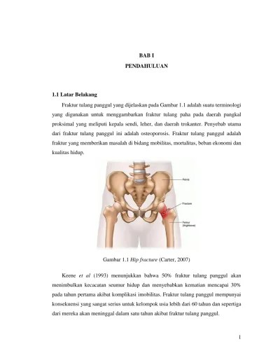 Gambar 1.1 Hip fracture (Carter, 2007)