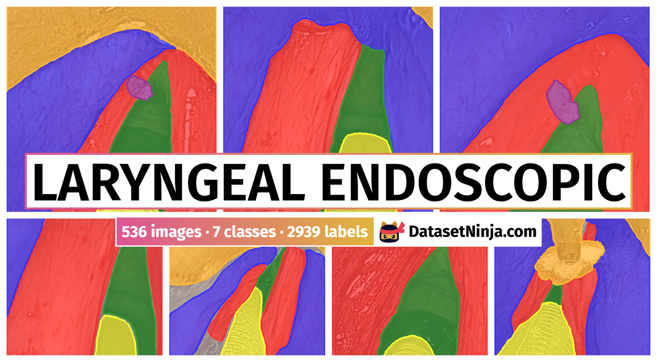 Laryngeal Endoscopic Dataset Ninja