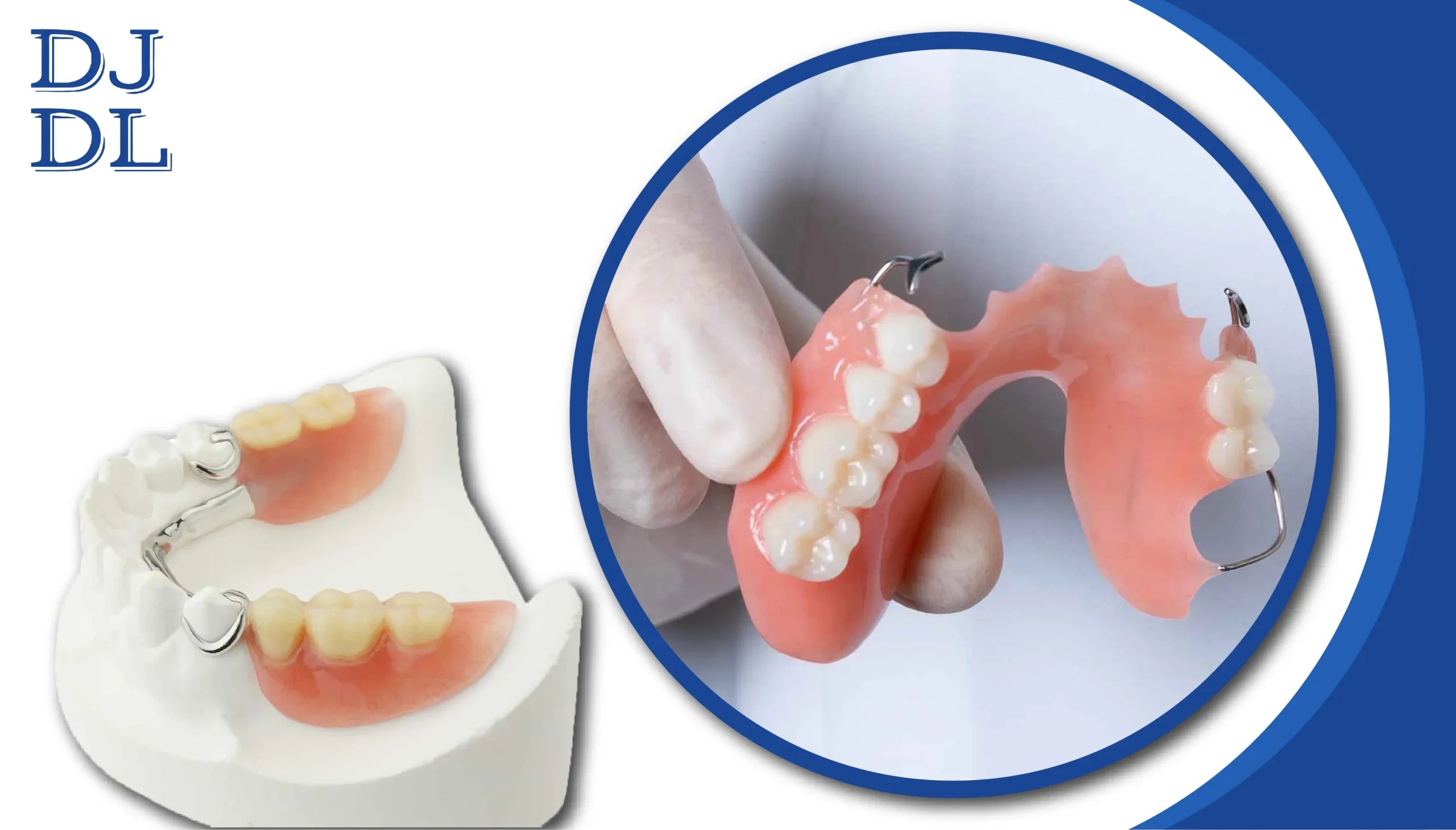 What are removable dentures? Dave Johnson Dental Lab