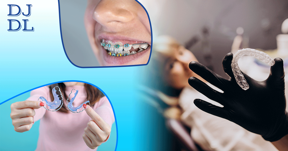 How do ortho retainers work Blog Dave Johnson Dental Lab