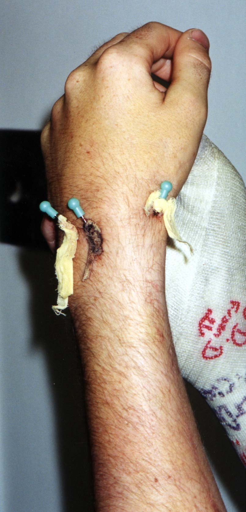 Image Arm1