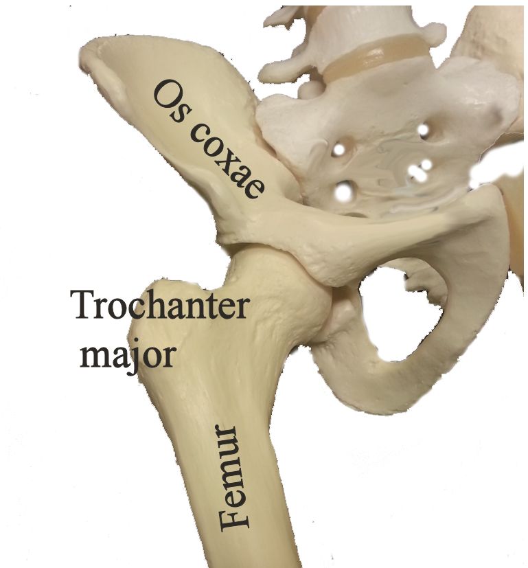 trochanterit innefattar inflammation kring höften