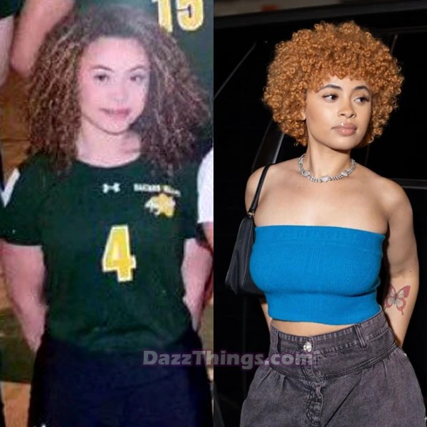 Ice Spice Plastic Surgery Comparison Photos