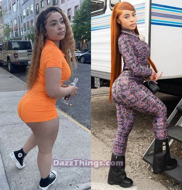 Ice Spice Plastic Surgery Comparison Photos