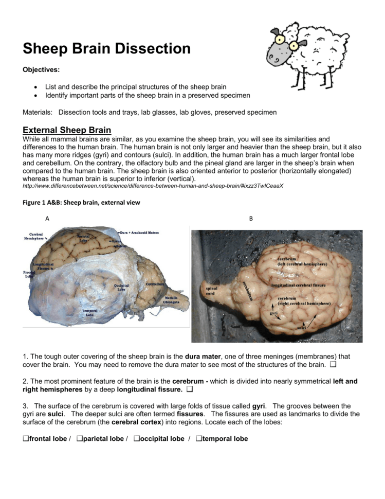 #frog dissection pre lab answer key pdf# read pdf fetal pig dissection post lab answer key logistics the. Web start studying sheep eye dissection quiz. Sheep Brain Dissection Worksheet β