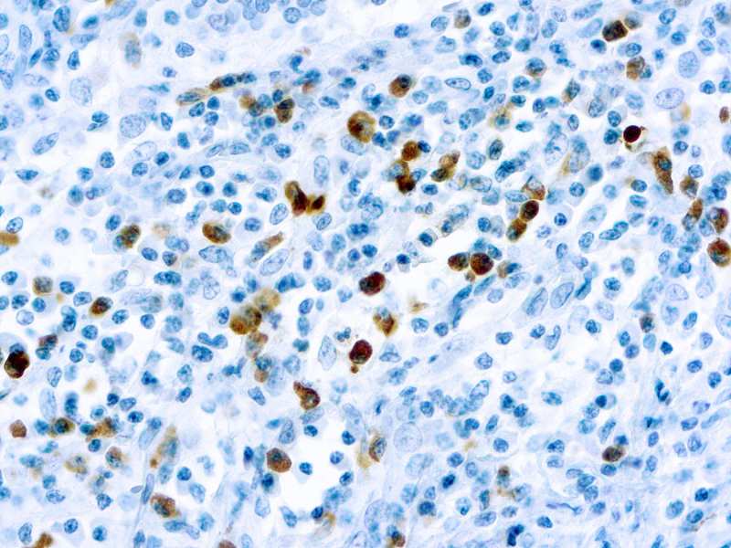 Lambda Light Chain Diagnostic BioSystems Immunohistochemistry