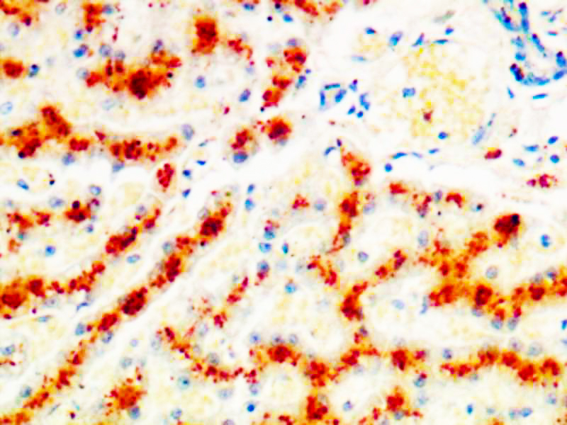 Copper Stain KT033 Diagnostic BioSystems(dbiosys) DBS