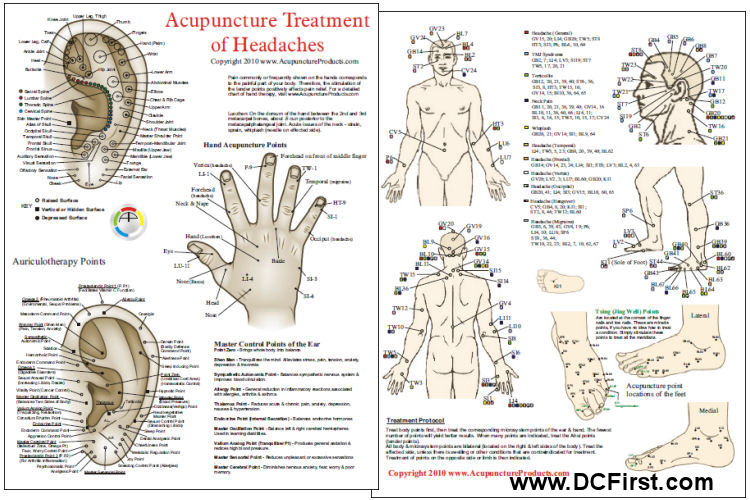 Acupuncture Treatment of Headaches Chart