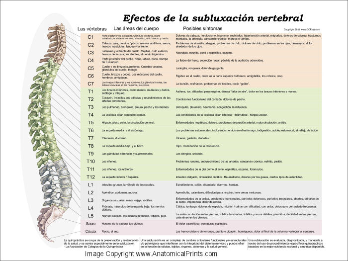 Effects of Spinal Subluxation Poster in Spanish