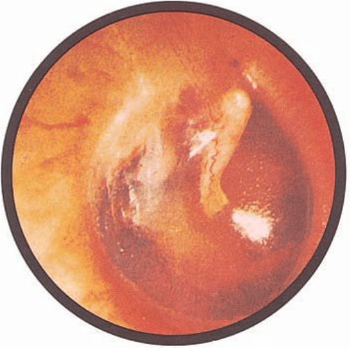 Differential Diagnosis of Hearing loss and Tinnitus