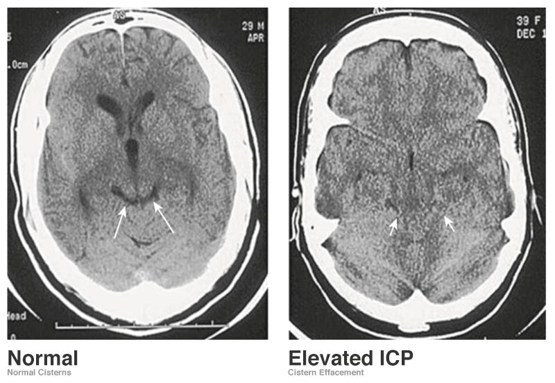 A Systematic Approach to the Interpretation of CT Head
