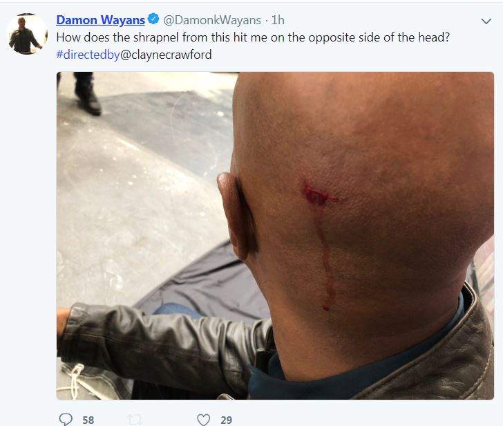 ‘Lethal Weapon’s Damon Wayans Shares Video & Photo Of OnSet Shrapnel