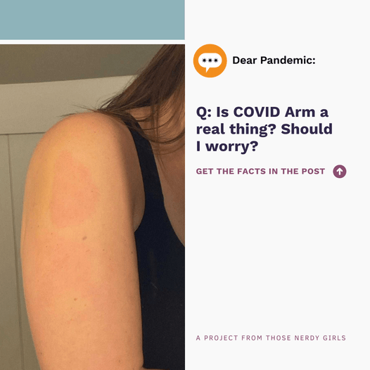 Is COVID Arm a real thing? Should I worry? — Those Nerdy Girls