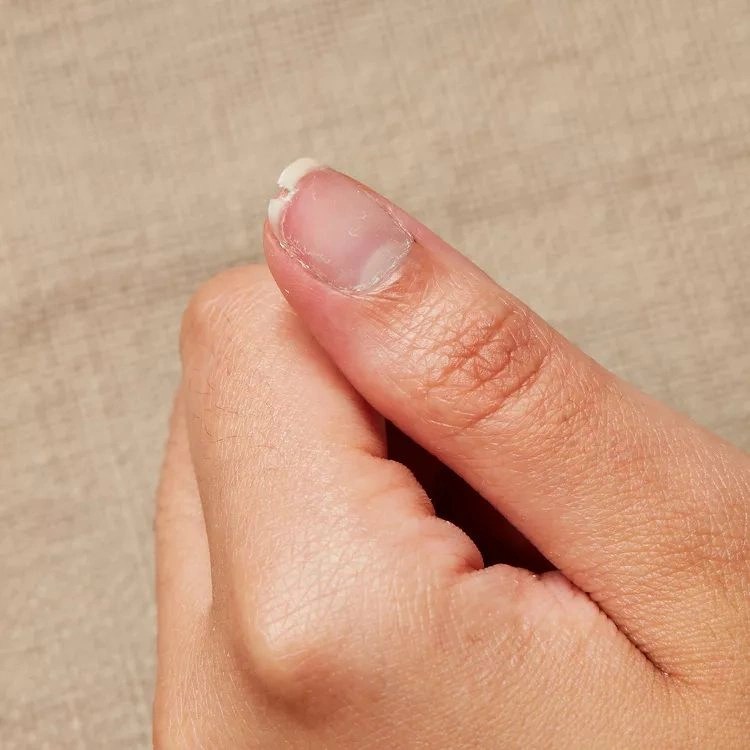How to Fix a Broken Nail at Home? Easy StepbyStep Guide
