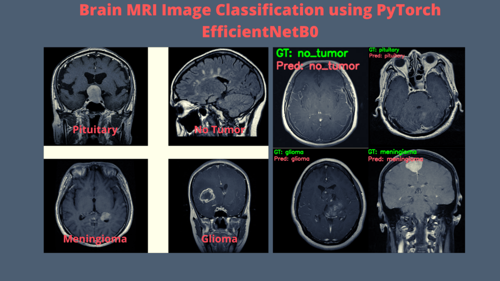 Brain MRI Classification using PyTorch