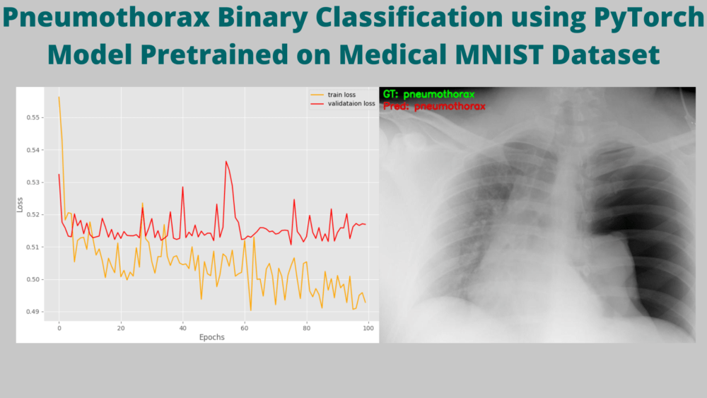 Pneumothorax Binary Classification using PyTorch Model Pretrained on