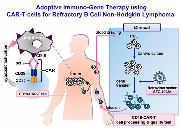 Phase2 trial of a CART cell therapy Therapy improves for