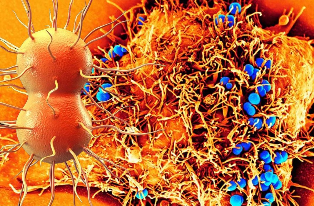 Blocking the ability of the bacterial pathogen that causes