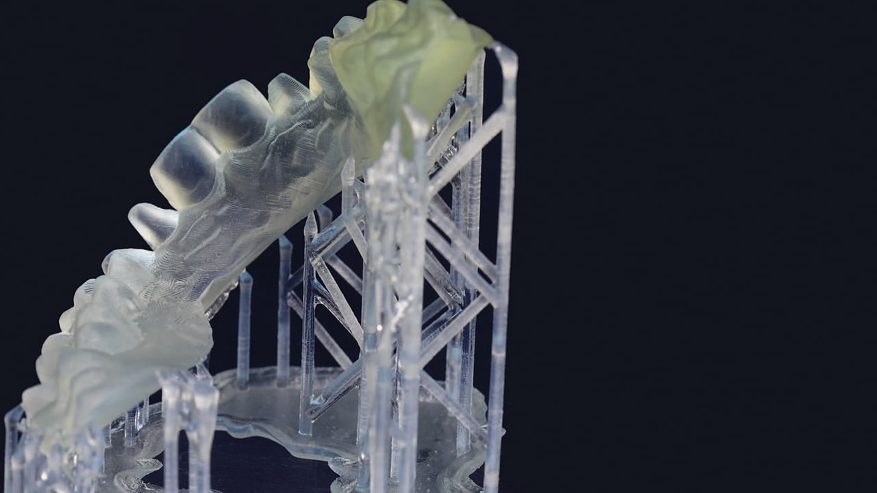 Stereolithography The Future of Dental Fabrication Decisions in