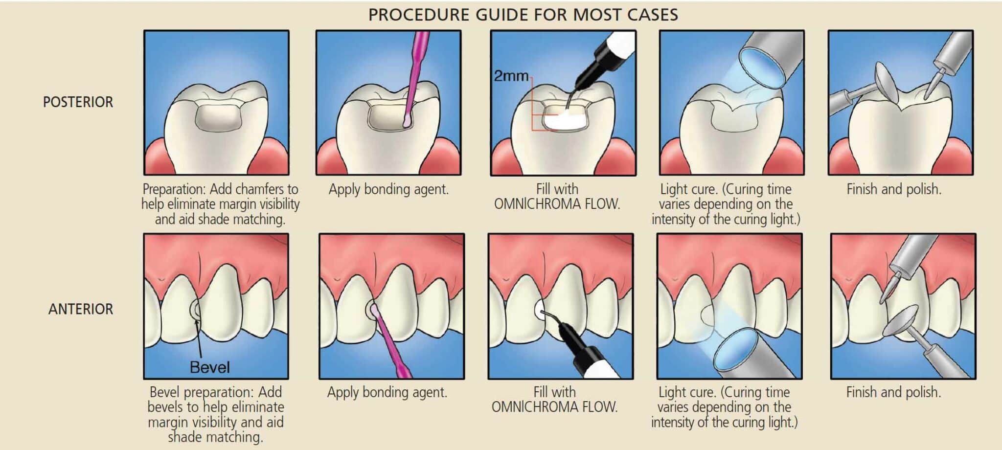 omnichromaguide Decisions in Dentistry