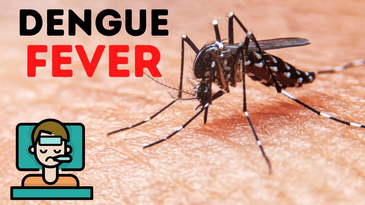 How many Days Dengue Fever Last Symptoms and Treatment Deco Facts