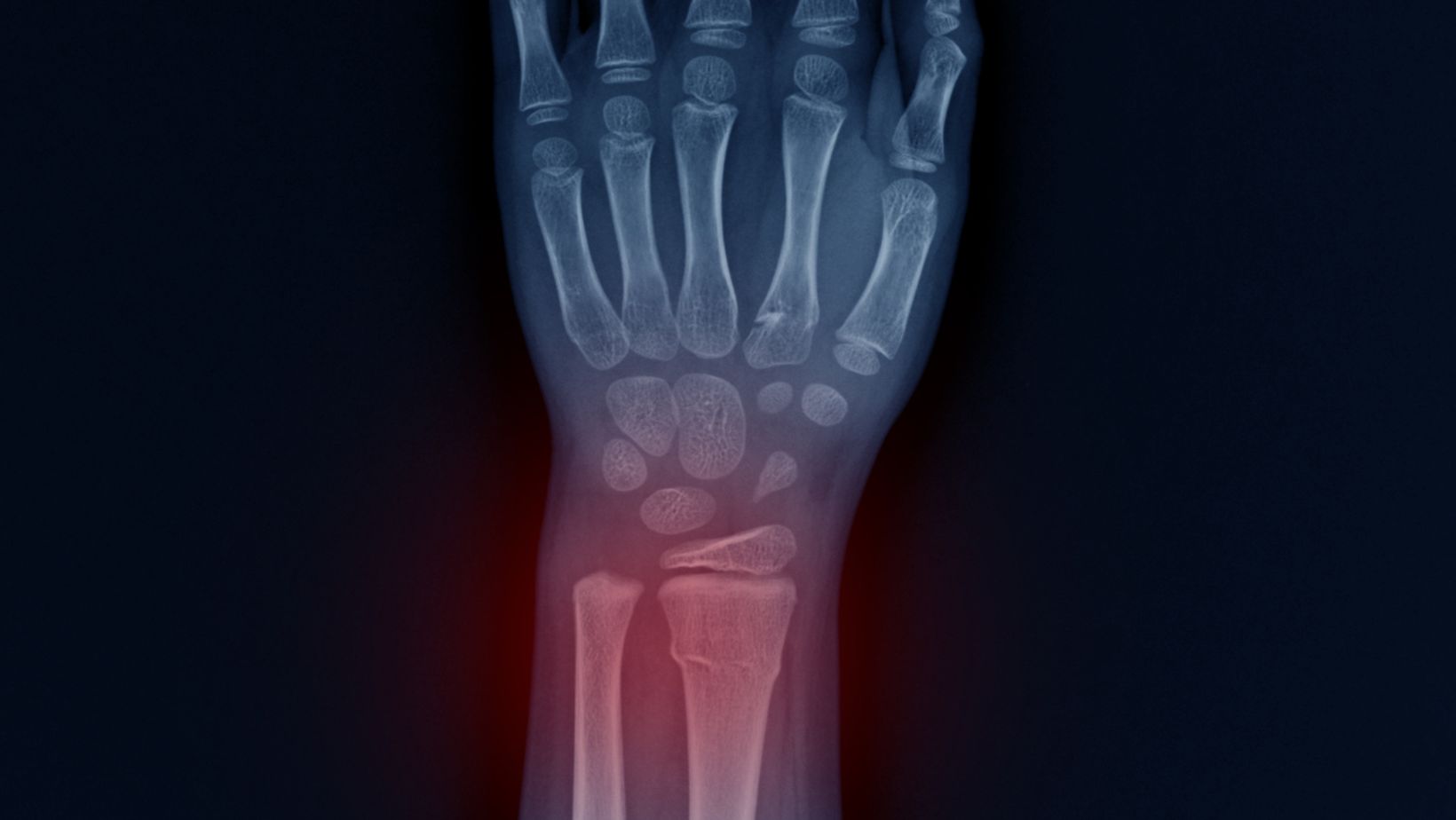 Examine The Causes of Left Wrist Pain ICD 10 Code Decorator Advice