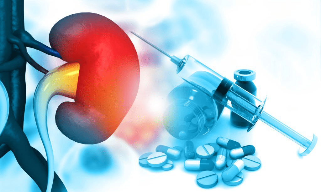 Is diabetes a risk factor for kidney disease? Best Mutlispeciality