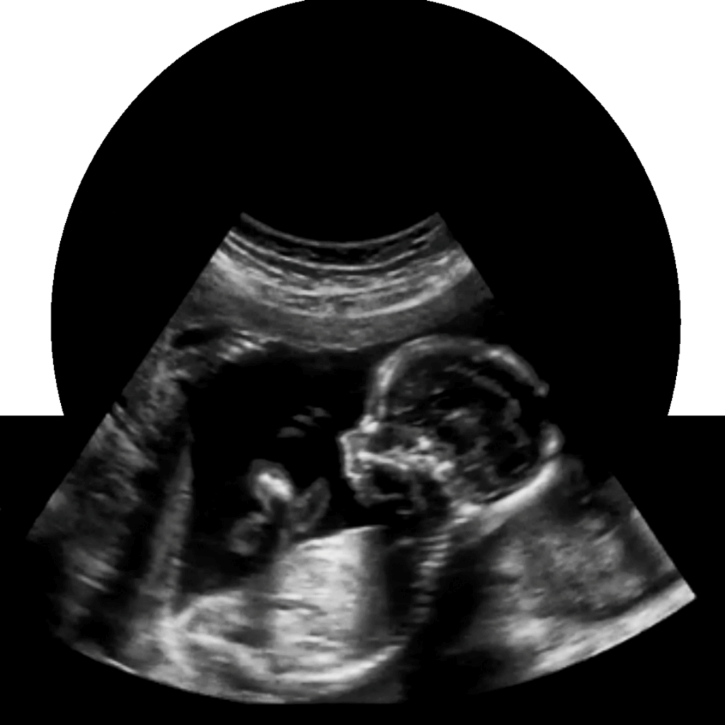 Book Your Fetal Echography Deep Medical Centre