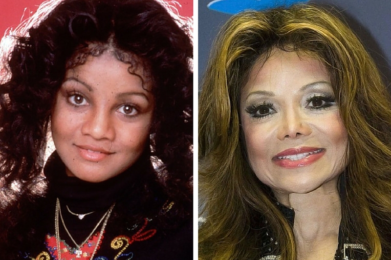 10 Worst Plastic Surgeries Gone Wrong on Celebrities