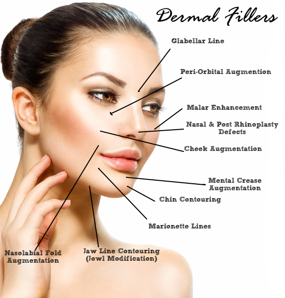 Dermal Facial Fillers Defy