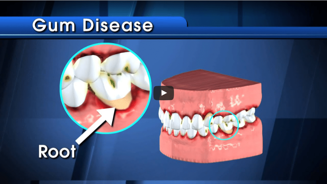 General Dentistry Bridgeport and Shelton, CT Dentist Dejesus Dental Group