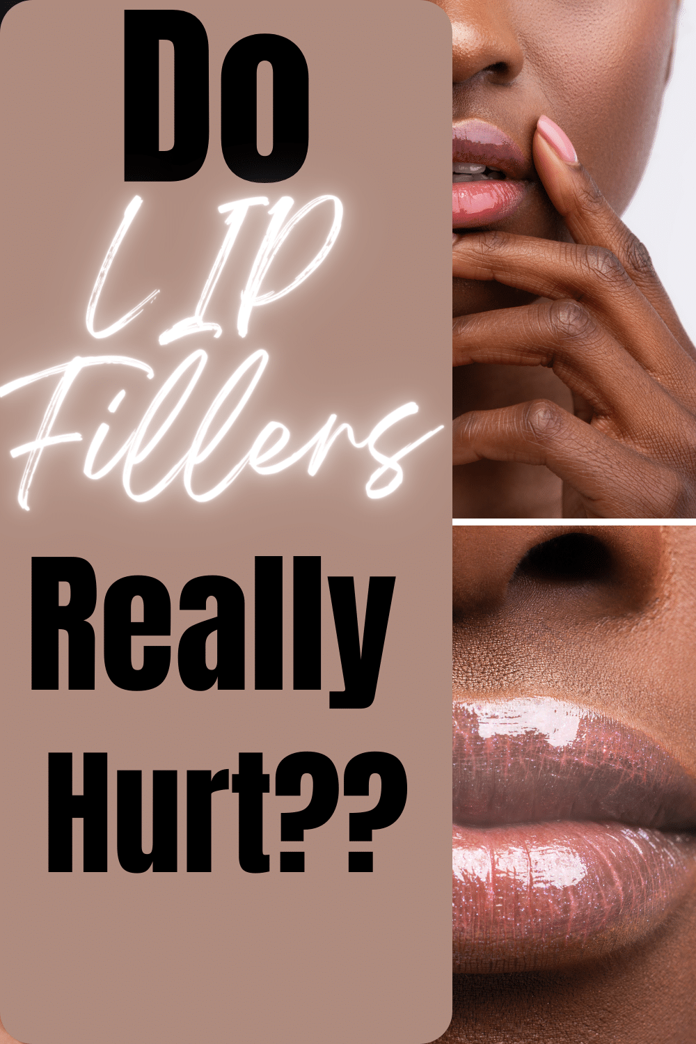 Navigating Lip Fillers A Personal Account of Enhancing Beauty
