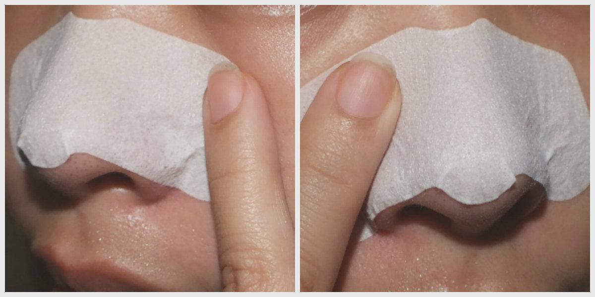 The Really Effective Way To Use Pore Strips Delirious Ideas Your
