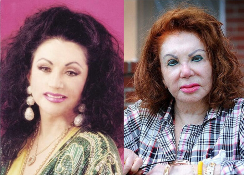 Sylvester Stallone's Mother Is 98 and She Is the Biggest Plastic Surgery Disaster