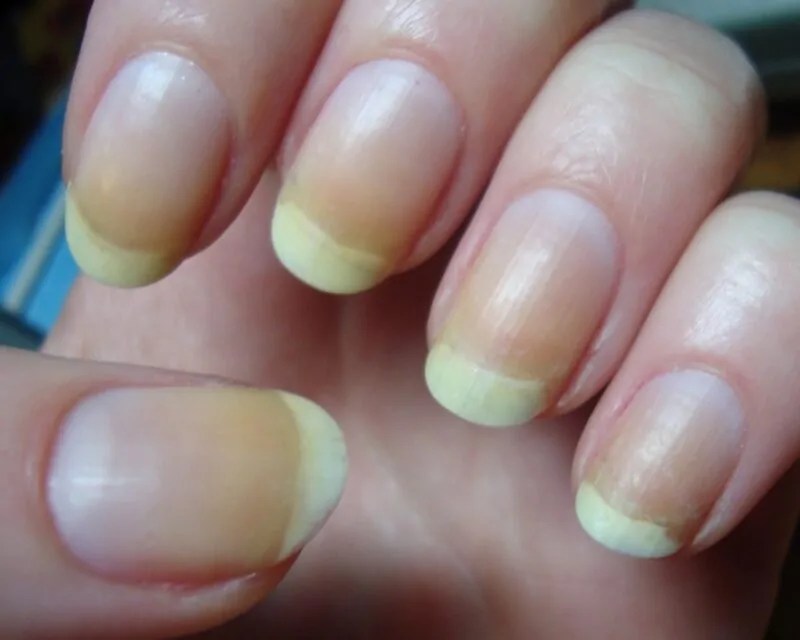 Why Do My Gel Nails Peel Off?