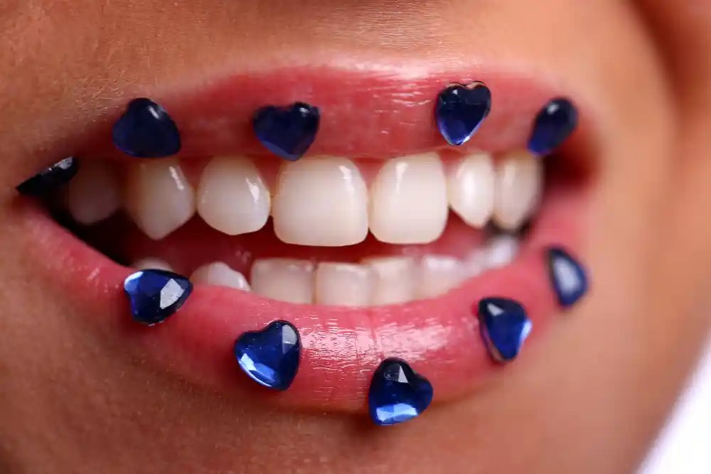 Diamond Tooth Implant DentaCenter