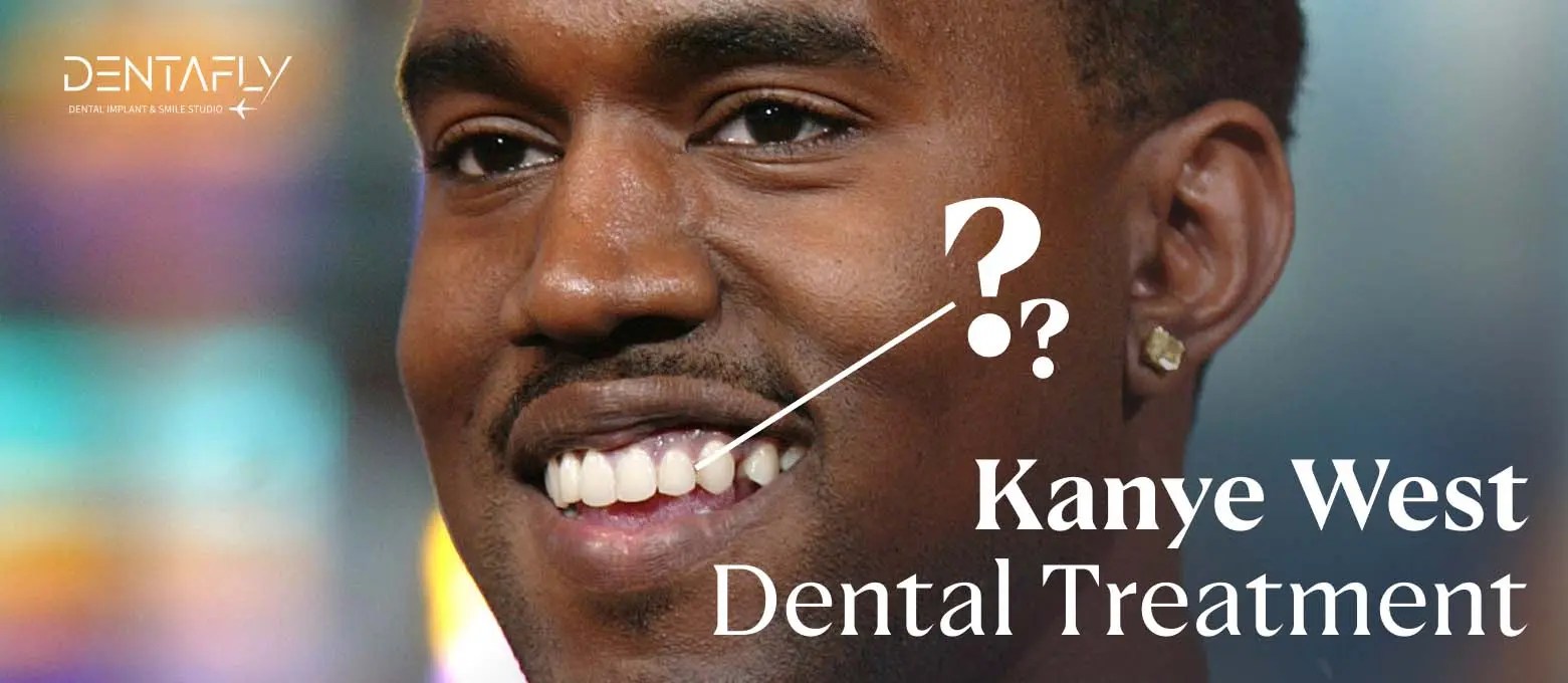 Kanye West Teeth 850k Titanium Transformation Story
