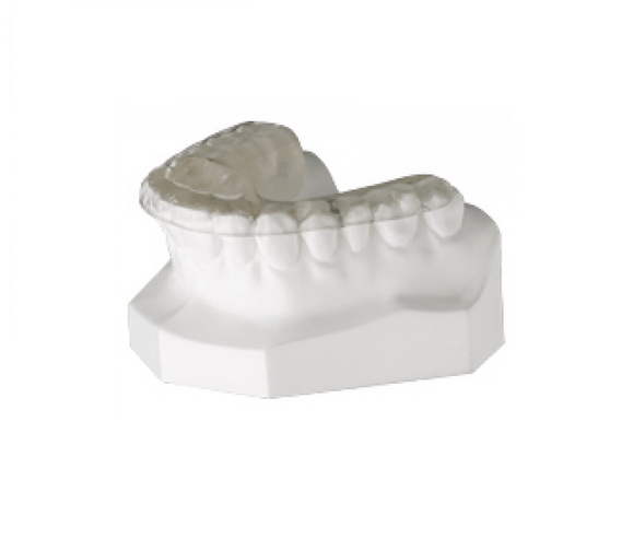 Anterior Repositioning Splint News Dentagama