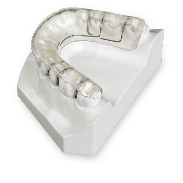 Tanner Splint News Dentagama