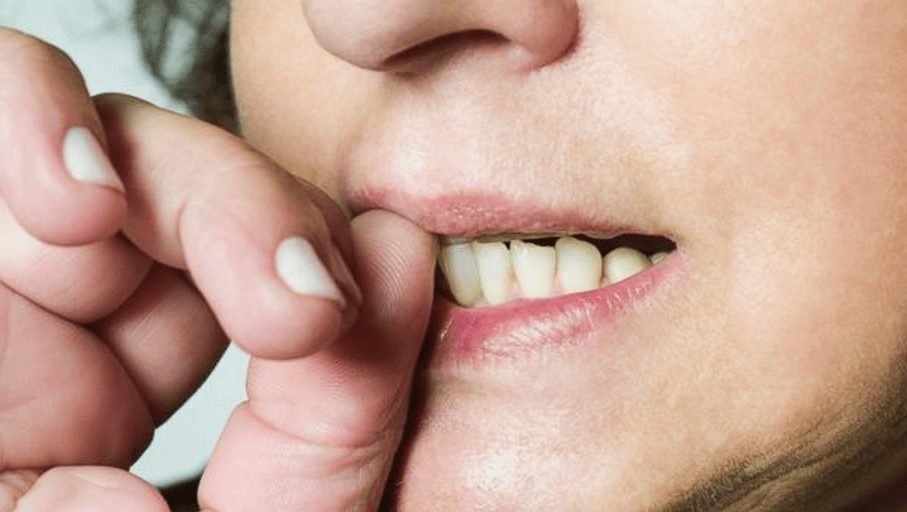 Effects of nail biting on oral health News Dentagama