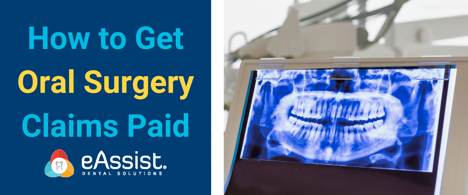 How to Get Oral Surgery Claims Paid eAssist Dental Billing