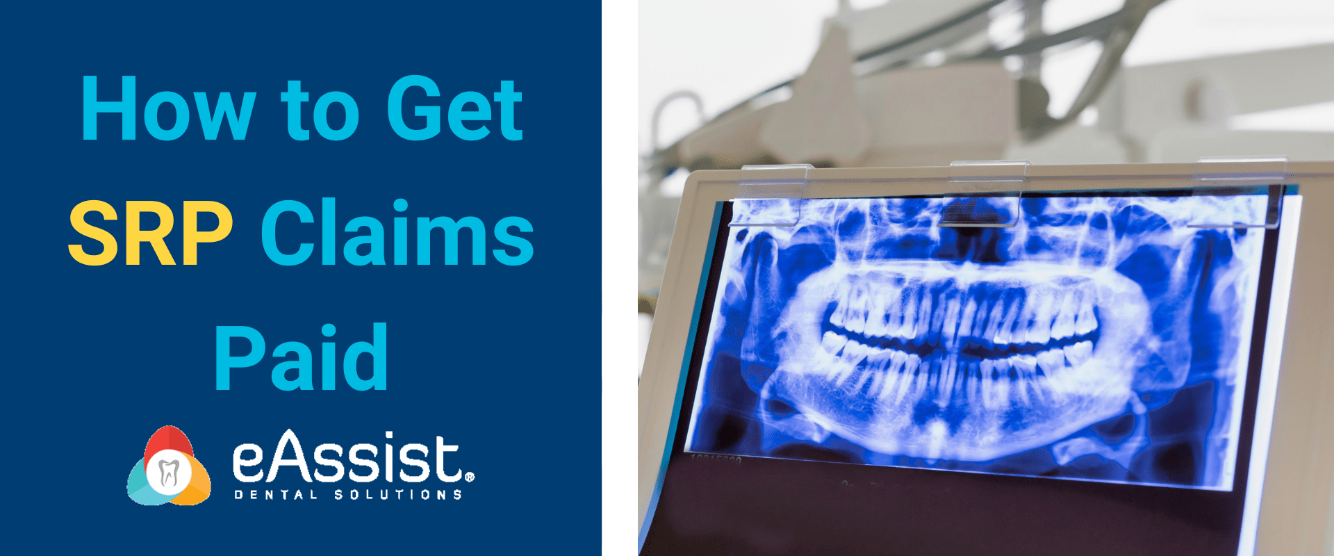 How to Get SRP Claims Paid eAssist Dental Billing