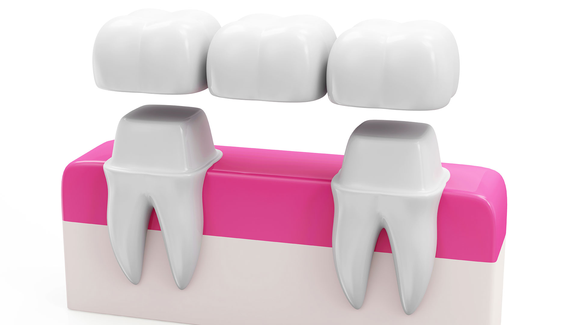 Bridges Dental Care Centre