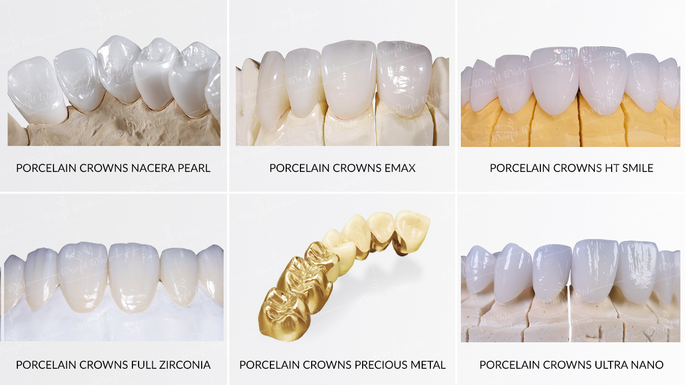 CROWN/VENEER MATERIALS AND PRODUCTION PROCEDURE Dental Center Vietnam